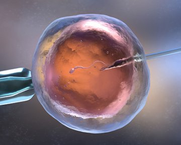 Father whose ex-partner forged his consent to IVF loses damages claim