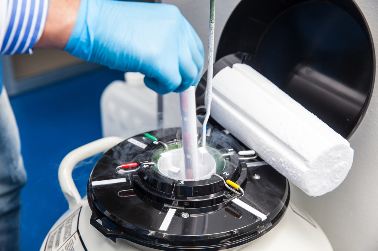 Demand for sperm and Brexit